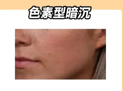 cb5335dfc28544ed36c96961c052baa0.png