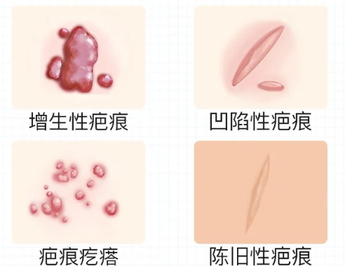 6459561cf056e47e3bcf6fb75b40ab93.png