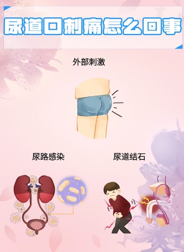 WeChat56c05d194d8b6e80163388ce0128dea9.jpg
